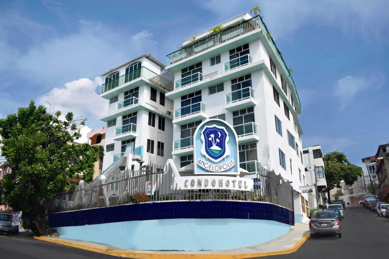 אקפולקו Suites Angelopolis מראה חיצוני תמונה